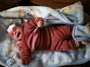 Foto: Bayi Karim Bermata Satu yang Sembunyi karena Serangan Assad Foto: Bayi Karim Bermata Satu yang Sembunyi karena Serangan Assad