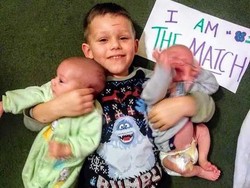 Kisah Balita Donor Sumsum Tulang Belakang untuk Adik Kembarnya