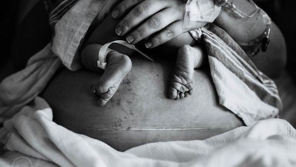 Foto-foto Menyentuh Saat Para Ibu Melahirkan