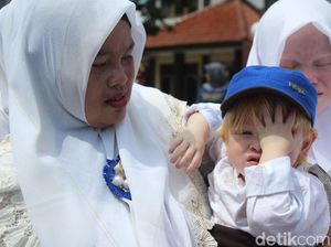 Sebelum Melahirkan Anak Albino, Warga Ciburuy Garut Mimpi Lihat Bulan Sebelum Melahirkan Anak Albino, Warga Ciburuy Garut Mimpi Lihat Bulan