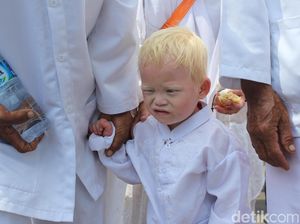 Sudah Tahu? Ternyata Ada Kampung Albino di Garut
