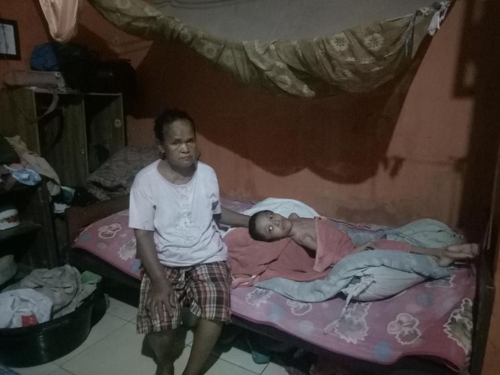 Arianti 16 Tahun Idap Hidrosefalus, Pemkot Makassar Turun Tangan