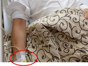 Terungkap! Ini Alasan Setya Novanto Dipasangi Jarum Infus Anak Terungkap! Ini Alasan Setya Novanto Dipasangi Jarum Infus Anak
