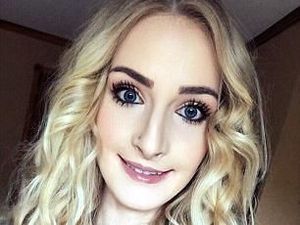 Perjuangan Menyakitkan Wanita Operasi Plastik karena Dibully Mirip Penyihir