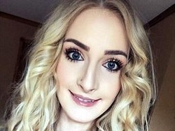 Perjuangan Menyakitkan Wanita Operasi Plastik karena Dibully Mirip Penyihir