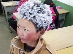 Bocah China Berambut Es Dikeluarkan dari Sekolah Barunya, Kenapa?