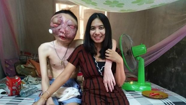 {Minggu} Bukti Cinta Sejati, Wanita Ini Setia Rawat Kekasih yang Derita Kanker Ganas