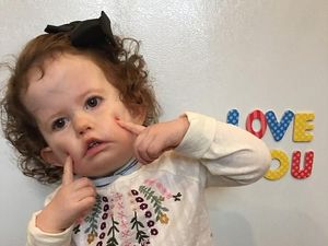 Idap Penyakit Saraf Langka, Bayi Ini Butuh Rp 1,7 M untuk Bisa Senyum