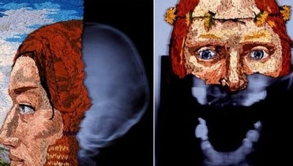 Seperti Apa Jadinya Jika Foto Rontgen Digabung dengan Karya Sulam?