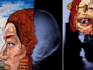 Seperti Apa Jadinya Jika Foto Rontgen Digabung dengan Karya Sulam?