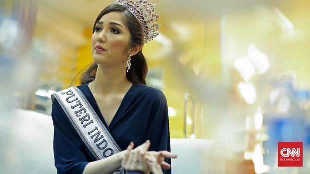 Dikritik, Sonia Fergina Puteri Indonesia 2018 Mengaku Syok