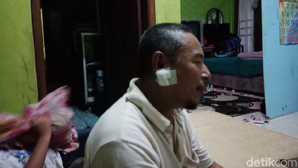 Perban di Rahang Abdul yang Ditusuk Saat Salat Subuh di Masjid