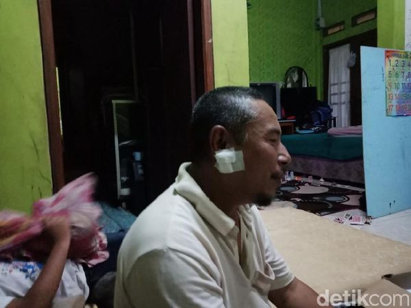 Perban di Rahang Abdul yang Ditusuk Saat Salat Subuh di Masjid