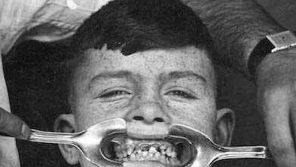 Pantas Banyak Orang Takut ke Dokter Gigi, Begini Toh Alatnya Zaman Dahulu