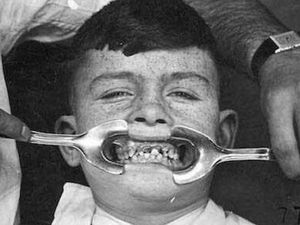 Pantas Banyak Orang Takut ke Dokter Gigi, Begini Toh Alatnya Zaman Dahulu