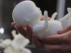 Keren! Hasil USG Bisa Dicetak Menyerupai Janin Lho