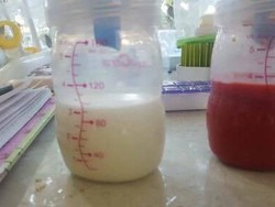 Begini Kondisi ASI Saat Ibu Mengalami Masalah Menyusui