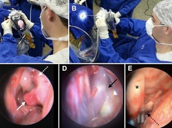 Dokter di Brazil Fungsikan iPhone Jadi Alat Bantu Operasi