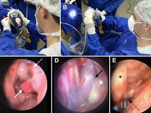 Dokter di Brazil Fungsikan iPhone Jadi Alat Bantu Operasi Dokter di Brazil Fungsikan iPhone Jadi Alat Bantu Operasi
