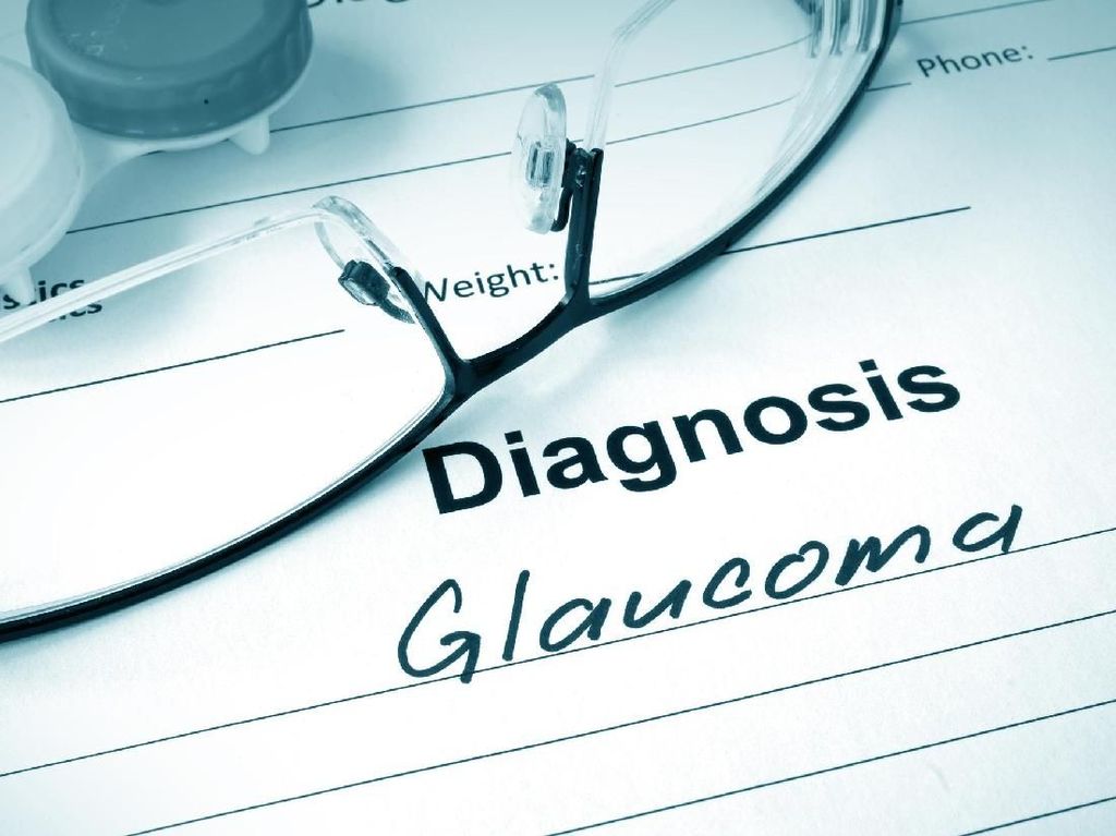 World Glaucoma Week, Waspada Bahaya Glaukoma si Pencuri Penglihatan