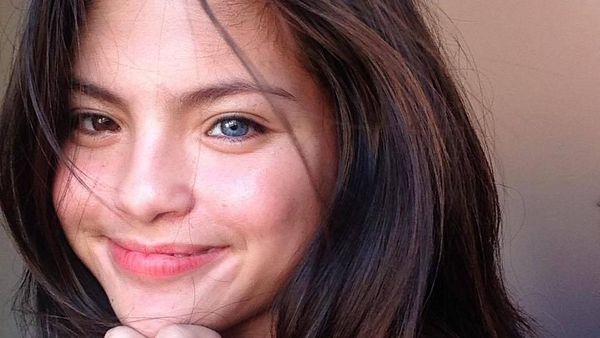 Foto: Cantiknya Julia Ostan, Remaja yang Punya 2 Warna Mata Berbeda