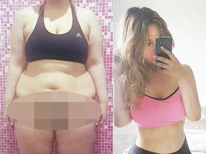 Gagal Jaga Berat Pasca Diet Keto, Si Cantik Ini Pangkas Lambungnya Gagal Jaga Berat Pasca Diet Keto, Si Cantik Ini Pangkas Lambungnya