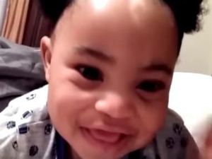 Bocah 2 Tahun Punya Tanda Lahir Lucu dan Langka di Rambutnya