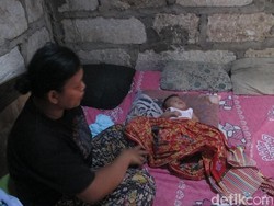 Tolong! Balita Ini Jantungnya Bocor dan Kelainan Tulang Leher