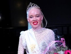 Beda Dari yang Lain, Kontes Kecantikan Ini Khusus untuk Albino