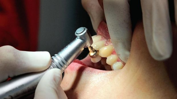 A dentist (L) uses a drill as she treats a patient on September 6, 2013, in Bailleul, northern France.  AFP PHOTO / PHILIPPE HUGUEN / AFP PHOTO / PHILIPPE HUGUEN