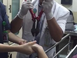 Tang Besar Pemotong Cincin Korban David Berfungsi Alat Operasi