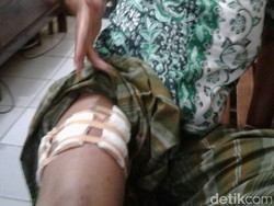 Anggota Satpol PP Rembang Tertembak Saat Berkelahi dengan Tetangga