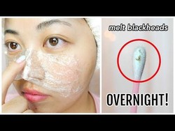 Wanita Ini Hilangkan Komedo Pakai Vaseline, Tak Disangka Hasilnya Memuaskan