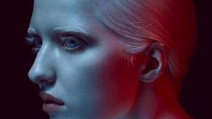 Foto: Nastya Zhidkova, Albino Bermata Indah yang Sukses Jadi Model