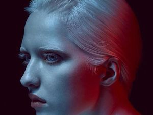 Foto: Nastya Zhidkova, Albino Bermata Indah yang Sukses Jadi Model Foto: Nastya Zhidkova, Albino Bermata Indah yang Sukses Jadi Model