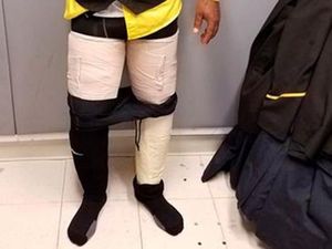 Pura-pura Pakai Perban, Pegawai Maskapai Ini Selundupkan Kokain