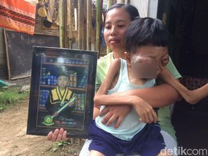 Kanker Kelenjar Getah Bening Renggut Keceriaan Bocah Ini