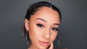 Viral, 10 Langkah Menghilangkan Bekas Jerawat dari Beauty Vlogger