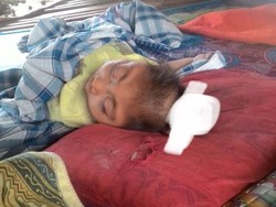 Tolong! Bayi Asal NTB Ini Otaknya Menyembul Keluar