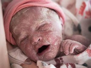 Beda Banget, Kondisi Bayi Baru Lahir Sebelum dan Sesudah Mandi