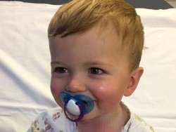 Pelajaran Berharga dari Kasus Batita yang Tersiram Teh Panas