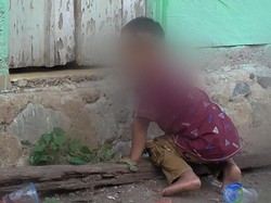 Psikolog Yakin Bocah yang Bertingkah Seperti Anjing Bisa Sembuh