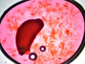 Foto-Foto Hasil Bidikan Mikroskop, Bisa Tebak Benda Apa?