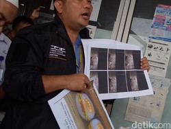 Bareskrim Buru Penyebar Video Syahroni Buktikan Telur Palsu