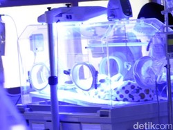 RSUD Sukabumi Rawat Bayi yang Alami Kelainan Perut Memendek