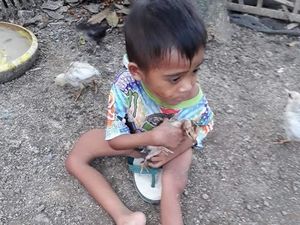 Potret Kemiskinan NTB, Bocah Ini Alami Bengkok Tulang Paha