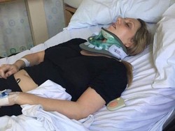 Cerita Wanita dengan Kondisi Kepala yang Bisa Copot Kapan Saja