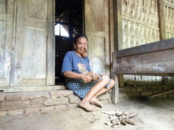 Kisah Sedih Sukeri dengan Wajah yang Tertutup Tumor