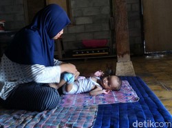 Balita di Boyolali Ini Jantungnya Bocor dan Harus Dioperasi