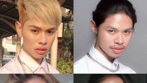 Pria Ini Operasi Plastik Demi Mirip Aktris Idola, Jadi Beda Banget!
